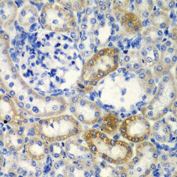 Immunohistochemistry: Deoxycytidylate deaminase Antibody [NBP3-38207] - Immunohistochemistry analysis of paraffin-embedded Rat kidney using Deoxycytidylate deaminase Rabbit pAb at dilution of 1:200 (40x lens). Microwave antigen retrieval performed with 0.01M PBS Buffer (pH 7.2) prior to IHC staining.