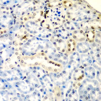 Immunohistochemistry: Deoxycytidylate deaminase Antibody [NBP3-38207] - Immunohistochemistry analysis of paraffin-embedded Mouse kidney using Deoxycytidylate deaminase Rabbit pAb at dilution of 1:200 (40x lens). Microwave antigen retrieval performed with 0.01M PBS Buffer (pH 7.2) prior to IHC staining.