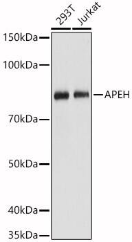 Western Blot: APEH Antibody [NBP3-38208] - Western blot analysis of various lysates, using [KO Validated] APEH Rabbit pAb at 1:1000 dilution.Secondary antibody: HRP-conjugated Goat anti-Rabbit IgG (H+L) at 1:10000 dilution.Lysates/proteins: 25ug per lane.Blocking buffer: 3% nonfat dry milk in TBST.Detection: ECL Basic Kit.Exposure time: 1s.