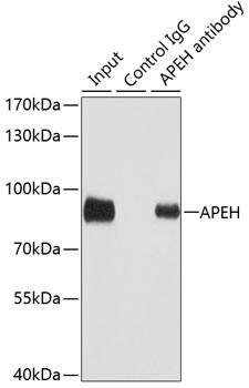 Immunoprecipitation: APEH Antibody [NBP3-38208] - Immunoprecipitation analysis of 100 ug extracts of SW480 cells using 3 ug APEH antibody. Western blot was performed from the immunoprecipitate using APEH antibody at a dilution of 1:1000.
