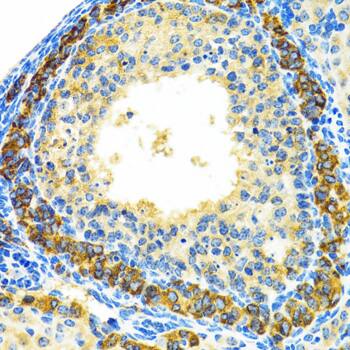 Immunohistochemistry: MRPL28 Antibody [NBP3-38209] - Immunohistochemistry analysis of paraffin-embedded Rat ovary using MRPL28 Rabbit pAb at dilution of 1:100 (40x lens). Microwave antigen retrieval performed with 0.01M PBS Buffer (pH 7.2) prior to IHC staining.