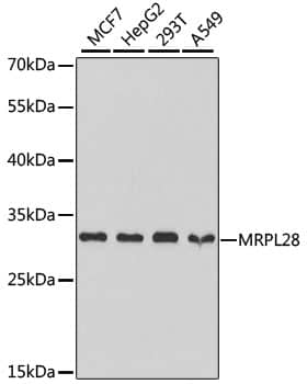 Western Blot: MRPL28 Antibody [NBP3-38209] - Western blot analysis of various lysates using MRPL28 Rabbit pAb at 1:1000 dilution.Secondary antibody: HRP-conjugated Goat anti-Rabbit IgG (H+L) at 1:10000 dilution.Lysates/proteins: 25ug per lane.Blocking buffer: 3% nonfat dry milk in TBST.Detection: ECL Basic Kit.