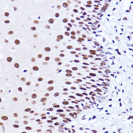 Immunohistochemistry: Matrin 3 Antibody [NBP3-38211] - Immunohistochemistry analysis of paraffin-embedded Human esophageal using Matrin 3 Rabbit pAb at dilution of 1:100 (40x lens). Microwave antigen retrieval performed with 0.01M PBS Buffer (pH 7.2) prior to IHC staining.