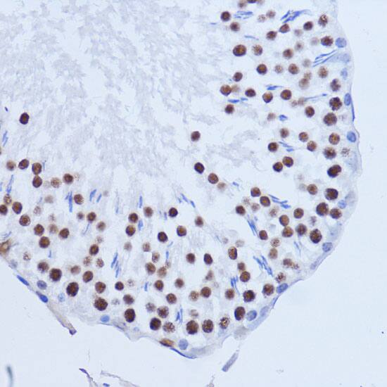 Immunohistochemistry: Matrin 3 Antibody [NBP3-38211] - Immunohistochemistry analysis of paraffin-embedded Rat testis using Matrin 3 Rabbit pAb at dilution of 1:100 (40x lens). Microwave antigen retrieval performed with 0.01M PBS Buffer (pH 7.2) prior to IHC staining.