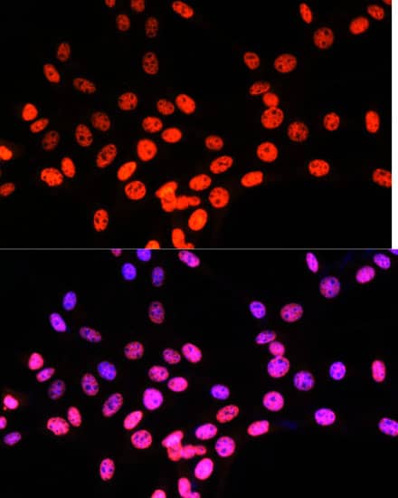 Immunocytochemistry/ Immunofluorescence: Matrin 3 Antibody [NBP3-38211] - Immunofluorescence analysis of NIH/3T3 cells using Matrin 3 Rabbit pAb at dilution of 1:100. Secondary antibody: Cy3-conjugated Goat anti-Rabbit IgG (H+L) at 1:500 dilution. Blue: DAPI for nuclear staining.