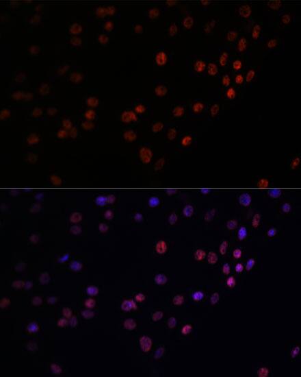 Immunocytochemistry/ Immunofluorescence: Matrin 3 Antibody [NBP3-38211] - Immunofluorescence analysis of C6 cells using Matrin 3 Rabbit pAb at dilution of 1:100. Secondary antibody: Cy3-conjugated Goat anti-Rabbit IgG (H+L) at 1:500 dilution. Blue: DAPI for nuclear staining.