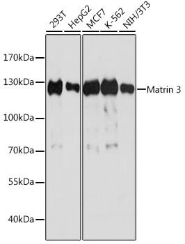 Western Blot: Matrin 3 Antibody [NBP3-38211] - Western blot analysis of various lysates using Matrin 3 Rabbit pAb at 1:1000 dilution.Secondary antibody: HRP-conjugated Goat anti-Rabbit IgG (H+L) at 1:10000 dilution.Lysates/proteins: 25ug per lane.Blocking buffer: 3% nonfat dry milk in TBST.Detection: ECL Basic Kit.Exposure time: 10s.