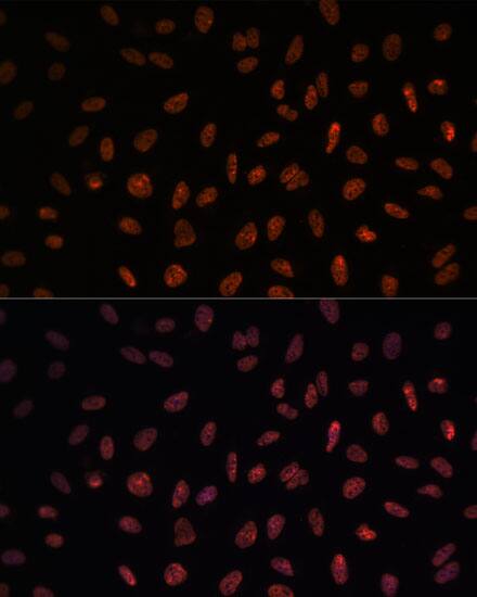 Immunocytochemistry/ Immunofluorescence: Matrin 3 Antibody [NBP3-38211] - Immunofluorescence analysis of U-2 OS cells using Matrin 3 Rabbit pAb at dilution of 1:100. Secondary antibody: Cy3-conjugated Goat anti-Rabbit IgG (H+L) at 1:500 dilution. Blue: DAPI for nuclear staining.