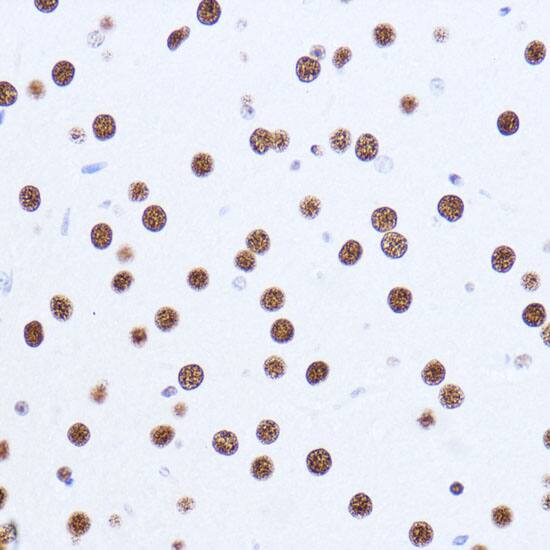 Immunohistochemistry: Matrin 3 Antibody [NBP3-38211] - Immunohistochemistry analysis of paraffin-embedded Mouse brain using Matrin 3 Rabbit pAb at dilution of 1:100 (40x lens). Microwave antigen retrieval performed with 0.01M PBS Buffer (pH 7.2) prior to IHC staining.