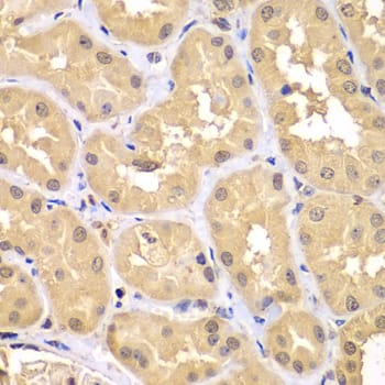 Immunohistochemistry: RNF36 Antibody [NBP3-38213] - Immunohistochemistry analysis of paraffin-embedded Human kidney using RNF36 Rabbit pAb at dilution of 1:100 (40x lens). Microwave antigen retrieval performed with 0.01M PBS Buffer (pH 7.2) prior to IHC staining.