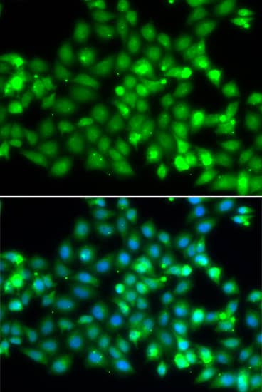 Immunocytochemistry/ Immunofluorescence: RNF36 Antibody [NBP3-38213] - Immunofluorescence analysis of A549 cells using RNF36 Rabbit pAb. Secondary antibody: Cy3-conjugated Goat anti-Rabbit IgG (H+L) at 1:500 dilution. Blue: DAPI for nuclear staining.