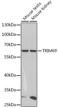 Western Blot: RNF36 Antibody [NBP3-38213] - Western blot analysis of various lysates using RNF36 Rabbit pAb at 1:1000 dilution.Secondary antibody: HRP-conjugated Goat anti-Rabbit IgG (H+L) at 1:10000 dilution.Lysates/proteins: 25ug per lane.Blocking buffer: 3% nonfat dry milk in TBST.Detection: ECL Basic Kit.Exposure time: 90s.