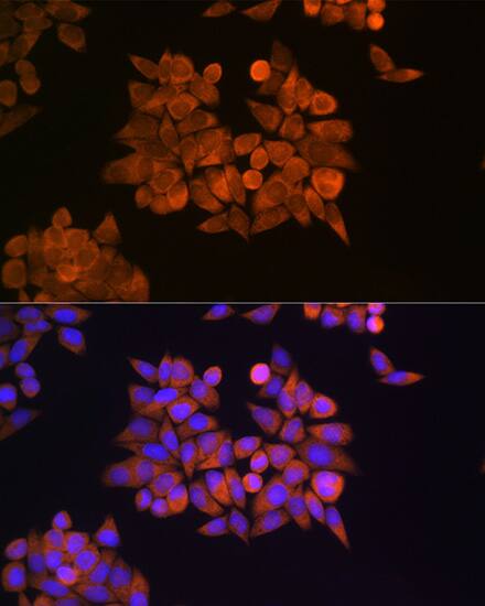 Immunocytochemistry/ Immunofluorescence: eRF1 Antibody [NBP3-38215] - Immunofluorescence analysis of HeLa cells using eRF1 Rabbit pAb at dilution of 1:100 (40x lens). Secondary antibody: Cy3-conjugated Goat anti-Rabbit IgG (H+L) at 1:500 dilution. Blue: DAPI for nuclear staining.