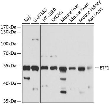 Western Blot: eRF1 Antibody [NBP3-38215] - Western blot analysis of various lysates using eRF1 Rabbit pAb at 1:1000 dilution.Secondary antibody: HRP-conjugated Goat anti-Rabbit IgG (H+L) at 1:10000 dilution.Lysates/proteins: 25ug per lane.Blocking buffer: 3% nonfat dry milk in TBST.Detection: ECL Basic Kit.Exposure time: 3s.