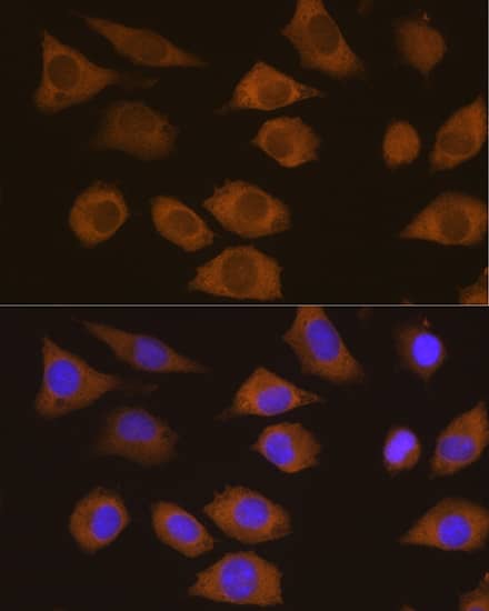 Immunocytochemistry/ Immunofluorescence: CSDE1 Antibody [NBP3-38216] - Immunofluorescence analysis of L929 cells using CSDE1 Rabbit pAb at dilution of 1:100. Secondary antibody: Cy3-conjugated Goat anti-Rabbit IgG (H+L) at 1:500 dilution. Blue: DAPI for nuclear staining.