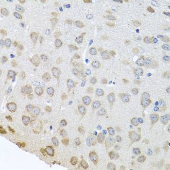 Immunohistochemistry: PABPC4 Antibody [NBP3-38218] - Immunohistochemistry analysis of paraffin-embedded Mouse brain using PABPC4 Rabbit pAb at dilution of 1:100 (40x lens). Microwave antigen retrieval performed with 0.01M PBS Buffer (pH 7.2) prior to IHC staining.
