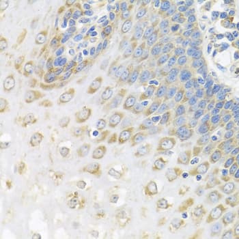 Immunohistochemistry: PABPC4 Antibody [NBP3-38218] - Immunohistochemistry analysis of paraffin-embedded Human esophagus using PABPC4 Rabbit pAb at dilution of 1:100 (40x lens). Microwave antigen retrieval performed with 0.01M PBS Buffer (pH 7.2) prior to IHC staining.