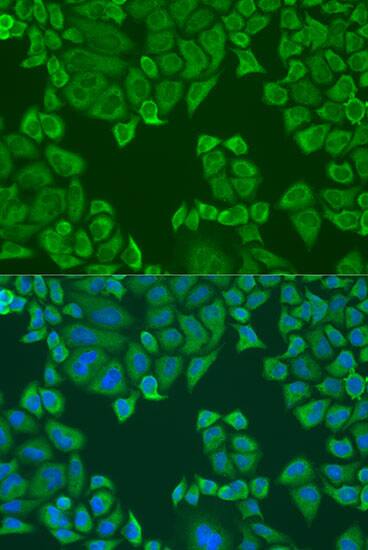 Immunocytochemistry/ Immunofluorescence: PABPC4 Antibody [NBP3-38218] - Immunofluorescence analysis of U2OS cells using PABPC4 Rabbit pAb at dilution of 1:100. Secondary antibody: Cy3-conjugated Goat anti-Rabbit IgG (H+L) at 1:500 dilution. Blue: DAPI for nuclear staining.