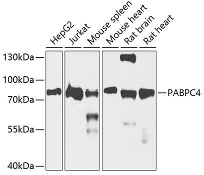 Western Blot: PABPC4 Antibody [NBP3-38218] - Western blot analysis of various lysates using PABPC4 Rabbit pAb at 1:1000 dilution.Secondary antibody: HRP-conjugated Goat anti-Rabbit IgG (H+L) at 1:10000 dilution.Lysates/proteins: 25ug per lane.Blocking buffer: 3% nonfat dry milk in TBST.Detection: ECL Basic Kit.Exposure time: 30s.