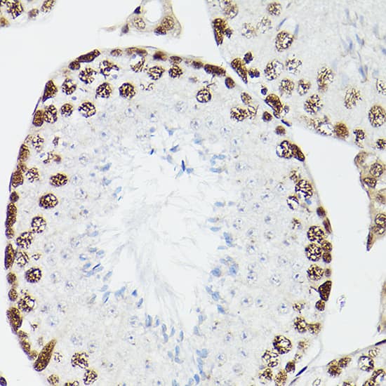 Immunohistochemistry: CPSF6 Antibody [NBP3-38219] - Immunohistochemistry analysis of paraffin-embedded Rat testis using CPSF6 Rabbit pAb at dilution of 1:100 (40x lens). High pressure antigen retrieval performed with 0.01M Citrate Bufferr (pH 6.0) prior to IHC staining.