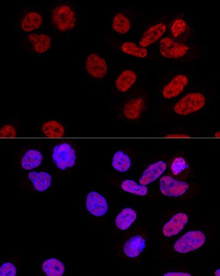 Immunocytochemistry/ Immunofluorescence: CPSF6 Antibody [NBP3-38219] - Confocal immunofluorescence analysis of U2OS cells using CPSF6 Rabbit pAb at dilution of 1:100. Blue: DAPI for nuclear staining.
