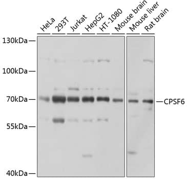 Western Blot: CPSF6 Antibody [NBP3-38219] - Western blot analysis of various lysates using CPSF6 Rabbit pAb at 1:1000 dilution.Secondary antibody: HRP-conjugated Goat anti-Rabbit IgG (H+L) at 1:10000 dilution.Lysates/proteins: 25ug per lane.Blocking buffer: 3% nonfat dry milk in TBST.Detection: ECL Basic Kit.Exposure time: 1s.