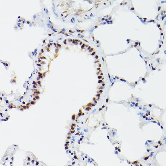 Immunohistochemistry: CPSF6 Antibody [NBP3-38219] - Immunohistochemistry analysis of paraffin-embedded Mouse lung using CPSF6 Rabbit pAb at dilution of 1:100 (40x lens). High pressure antigen retrieval performed with 0.01M Citrate Bufferr (pH 6.0) prior to IHC staining.