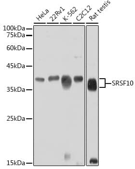 Western Blot: FUSIP1 Antibody [NBP3-38220] - Western blot analysis of various lysates using FUSIP1 Rabbit pAb at 1:1000 dilution.Secondary antibody: HRP-conjugated Goat anti-Rabbit IgG (H+L) at 1:10000 dilution.Lysates/proteins: 25ug per lane.Blocking buffer: 3% nonfat dry milk in TBST.Detection: ECL Basic Kit.Exposure time: 30s.