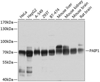 Western Blot: PAIP1 Antibody [NBP3-38222] - Western blot analysis of various lysates using PAIP1 Rabbit pAb at 1:1000 dilution.Secondary antibody: HRP-conjugated Goat anti-Rabbit IgG (H+L) at 1:10000 dilution.Lysates/proteins: 25ug per lane.Blocking buffer: 3% nonfat dry milk in TBST.Detection: ECL Basic Kit.Exposure time: 30s.