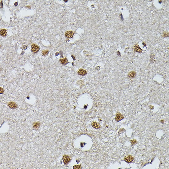 Immunohistochemistry: PRPF4 Antibody [NBP3-38223] - Immunohistochemistry analysis of paraffin-embedded Human brain using PRPF4 Rabbit pAb at dilution of 1:200 (40x lens). High pressure antigen retrieval performed with 0.01M Citrate Bufferr (pH 6.0) prior to IHC staining.