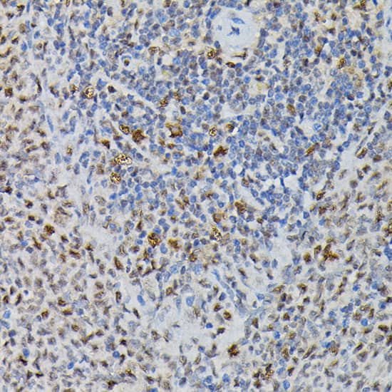 Immunohistochemistry: PRPF4 Antibody [NBP3-38223] - Immunohistochemistry analysis of paraffin-embedded Rat spleen using PRPF4 Rabbit pAb at dilution of 1:200 (40x lens). High pressure antigen retrieval performed with 0.01M Citrate Bufferr (pH 6.0) prior to IHC staining.