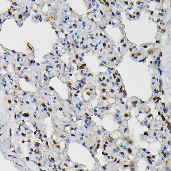 Immunohistochemistry: PRPF4 Antibody [NBP3-38223] - Immunohistochemistry analysis of paraffin-embedded Rat lung using PRPF4 Rabbit pAb at dilution of 1:200 (40x lens). High pressure antigen retrieval performed with 0.01M Citrate Bufferr (pH 6.0) prior to IHC staining.