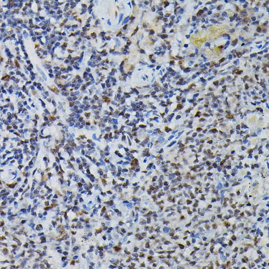 Immunohistochemistry: PRPF4 Antibody [NBP3-38223] - Immunohistochemistry analysis of paraffin-embedded Mouse spleen using PRPF4 Rabbit pAb at dilution of 1:200 (40x lens). High pressure antigen retrieval performed with 0.01M Citrate Bufferr (pH 6.0) prior to IHC staining.