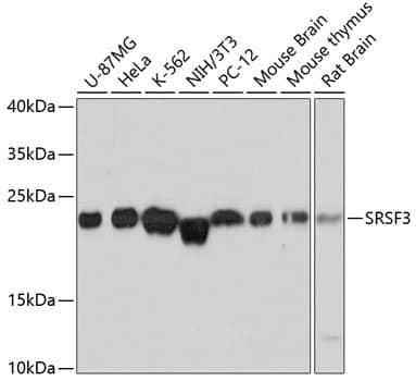 Western Blot: SFRS3 Antibody [NBP3-38224] - Western blot analysis of various lysates using SFRS3 Rabbit pAb at 1:3000 dilution.Secondary antibody: HRP-conjugated Goat anti-Rabbit IgG (H+L) at 1:10000 dilution.Lysates/proteins: 25ug per lane.Blocking buffer: 3% nonfat dry milk in TBST.Detection: ECL Basic Kit.Exposure time: 30s.