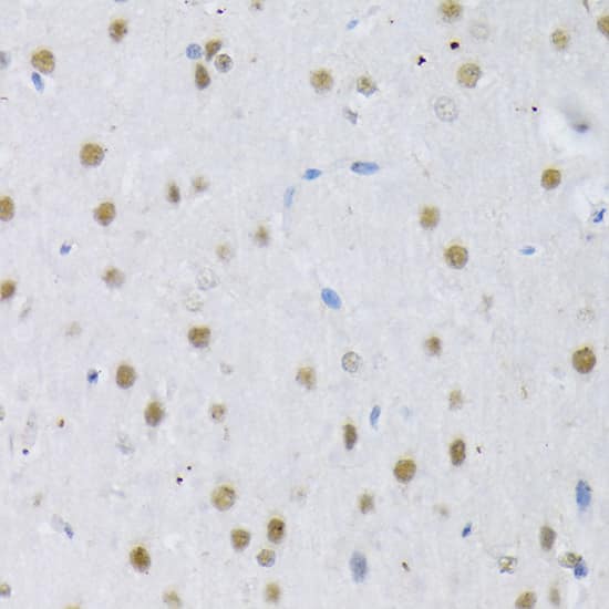 Immunohistochemistry: SFRS3 Antibody [NBP3-38224] - Immunohistochemistry analysis of paraffin-embedded Rat brain using SFRS3 Rabbit pAb at dilution of 1:100 (40x lens). Microwave antigen retrieval performed with 0.01M PBS Buffer (pH 7.2) prior to IHC staining.