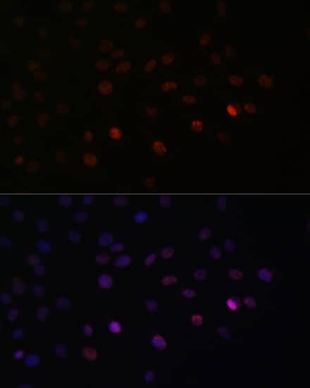 Immunocytochemistry/ Immunofluorescence: SFRS3 Antibody [NBP3-38224] - Immunofluorescence analysis of C6 cells using SFRS3 Rabbit pAb at dilution of 1:100. Secondary antibody: Cy3-conjugated Goat anti-Rabbit IgG (H+L) at 1:500 dilution. Blue: DAPI for nuclear staining.