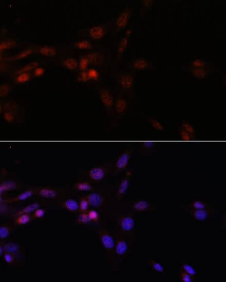 Immunocytochemistry/ Immunofluorescence: SFRS3 Antibody [NBP3-38224] - Immunofluorescence analysis of NIH/3T3 cells using SFRS3 Rabbit pAb at dilution of 1:100. Secondary antibody: Cy3-conjugated Goat anti-Rabbit IgG (H+L) at 1:500 dilution. Blue: DAPI for nuclear staining.