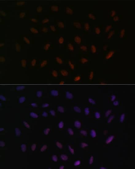 Immunocytochemistry/ Immunofluorescence: SFRS3 Antibody [NBP3-38224] - Immunofluorescence analysis of U-2 OS cells using SFRS3 Rabbit pAb at dilution of 1:100. Secondary antibody: Cy3-conjugated Goat anti-Rabbit IgG (H+L) at 1:500 dilution. Blue: DAPI for nuclear staining.