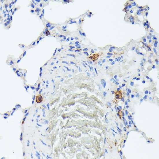 Immunohistochemistry: TIAL1 Antibody [NBP3-38225] - Immunohistochemistry analysis of paraffin-embedded Rat lung using TIAL1 Rabbit pAb at dilution of 1:100 (40x lens). Microwave antigen retrieval performed with 0.01M PBS Buffer (pH 7.2) prior to IHC staining.