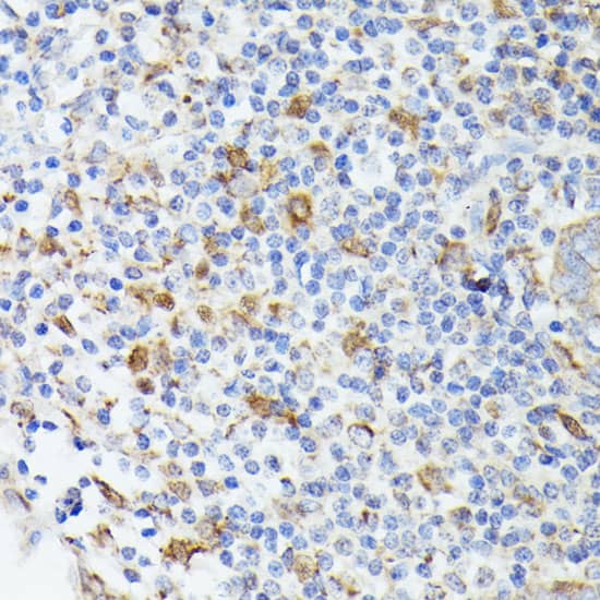 Immunohistochemistry TIAL1 Antibody