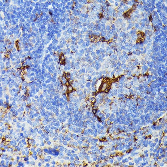 Immunohistochemistry: TIAL1 Antibody [NBP3-38225] - Immunohistochemistry analysis of paraffin-embedded Mouse spleen using TIAL1 Rabbit pAb at dilution of 1:100 (40x lens). Microwave antigen retrieval performed with 0.01M PBS Buffer (pH 7.2) prior to IHC staining.