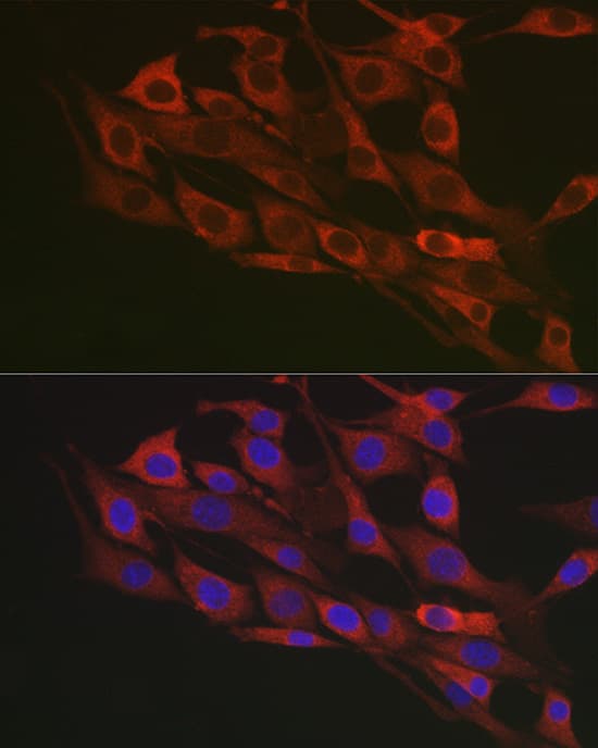 Immunocytochemistry/ Immunofluorescence: Flotillin-1 Antibody [NBP3-38231] - Immunofluorescence analysis of NIH/3T3 cells using Flotillin-1 Rabbit pAb at dilution of 1:100 (40x lens). Secondary antibody: Cy3-conjugated Goat anti-Rabbit IgG (H+L) at 1:500 dilution. Blue: DAPI for nuclear staining.