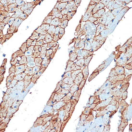 Immunohistochemistry: Flotillin-1 Antibody [NBP3-38231] - Immunohistochemistry analysis of paraffin-embedded Rat heart using [KO Validated] Flotillin-1 Rabbit pAb at dilution of 1:100 (40x lens). Microwave antigen retrieval performed with 0.01M Tris/EDTA Buffer (pH 9.0) prior to IHC staining.