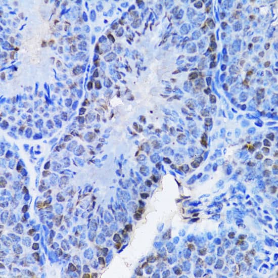 Immunohistochemistry: Cbx8 Antibody [NBP3-38232] - Immunohistochemistry analysis of paraffin-embedded Mouse testis using Cbx8 Rabbit pAb at dilution of 1:100 (40x lens). Microwave antigen retrieval performed with 0.01M PBS Buffer (pH 7.2) prior to IHC staining.