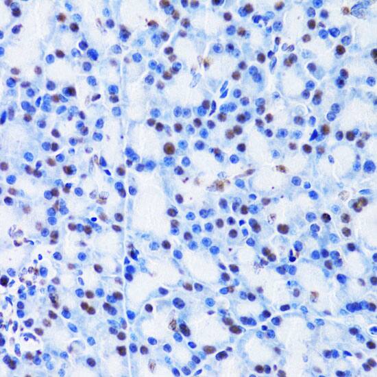 Immunohistochemistry: Cbx8 Antibody [NBP3-38232] - Immunohistochemistry analysis of paraffin-embedded Rat pancreas using Cbx8 Rabbit pAb at dilution of 1:100 (40x lens). Microwave antigen retrieval performed with 0.01M PBS Buffer (pH 7.2) prior to IHC staining.