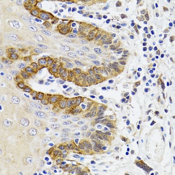 Immunohistochemistry: ESD Antibody [NBP3-38233] - Immunohistochemistry analysis of paraffin-embedded Human trachea using ESD Rabbit pAb at dilution of 1:100 (40x lens). Microwave antigen retrieval performed with 0.01M PBS Buffer (pH 7.2) prior to IHC staining.