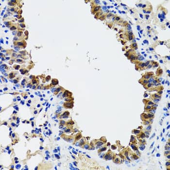 Immunohistochemistry: ESD Antibody [NBP3-38233] - Immunohistochemistry analysis of paraffin-embedded Mouse lung using ESD Rabbit pAb at dilution of 1:100 (40x lens). Microwave antigen retrieval performed with 0.01M PBS Buffer (pH 7.2) prior to IHC staining.