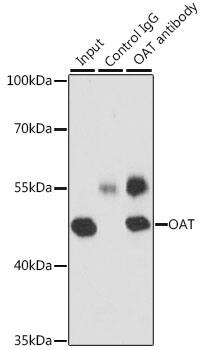 Immunoprecipitation: OAT Antibody [NBP3-38234] - Immunoprecipitation analysis of 200 ug extracts of MCF-7 cells, using 3 ug OAT antibody. Western blot was performed from the immunoprecipitate using OAT antibody at a dilution of 1:1000.