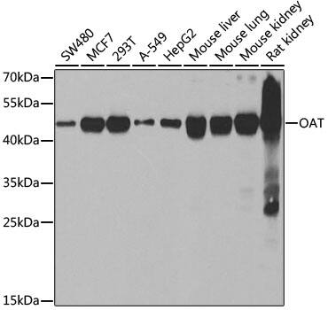 Western Blot: OAT Antibody [NBP3-38234] - Western blot analysis of various lysates using OAT Rabbit pAb at 1:2000 dilution.Secondary antibody: HRP-conjugated Goat anti-Rabbit IgG (H+L) at 1:10000 dilution.Lysates/proteins: 25 ug per lane.Blocking buffer: 3% nonfat dry milk in TBST.Detection: ECL Basic Kit.Negative control (NC): RT4.Exposure time: 30s.