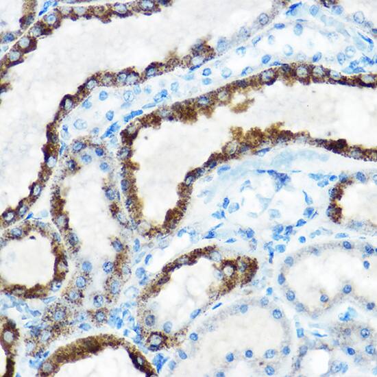 Immunohistochemistry: OAT Antibody [NBP3-38234] - Immunohistochemistry analysis of paraffin-embedded Rat kidney using OAT Rabbit pAb at dilution of 1:100 (40x lens). High pressure antigen retrieval performed with 0.01M Citrate Bufferr (pH 6.0) prior to IHC staining.